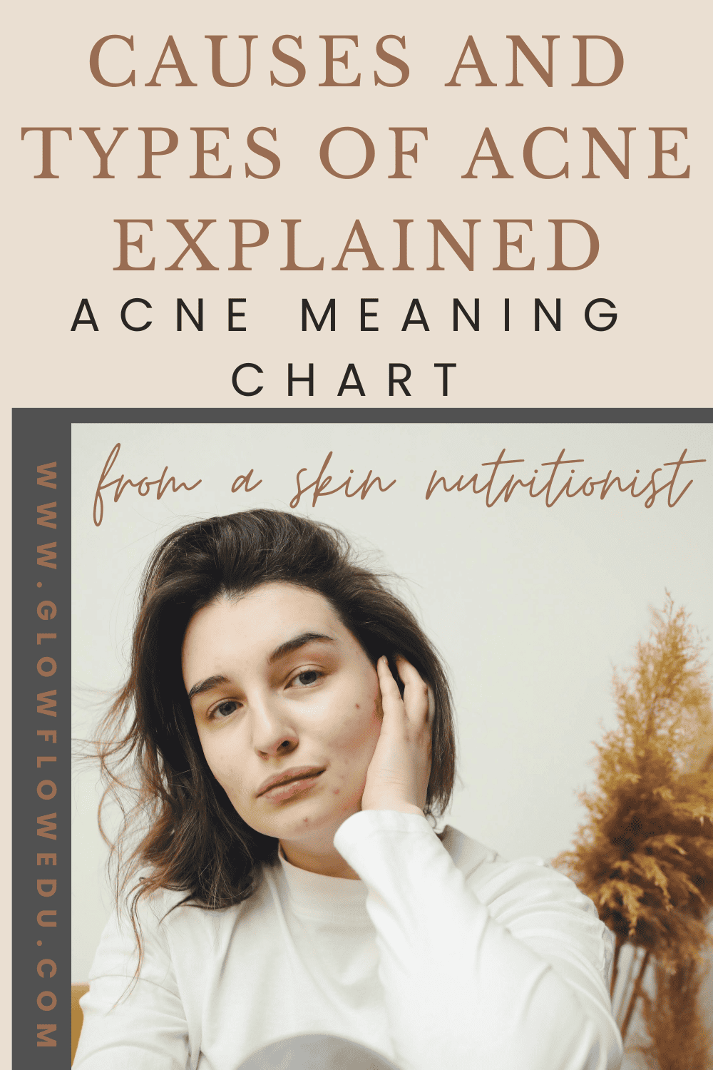 Acne Meaning Chart: Causes and Types of Acne - glow flow edu